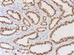 3780B | Control Slides:Immunopathology;Thyroid Transcription Factor (TTF-1)